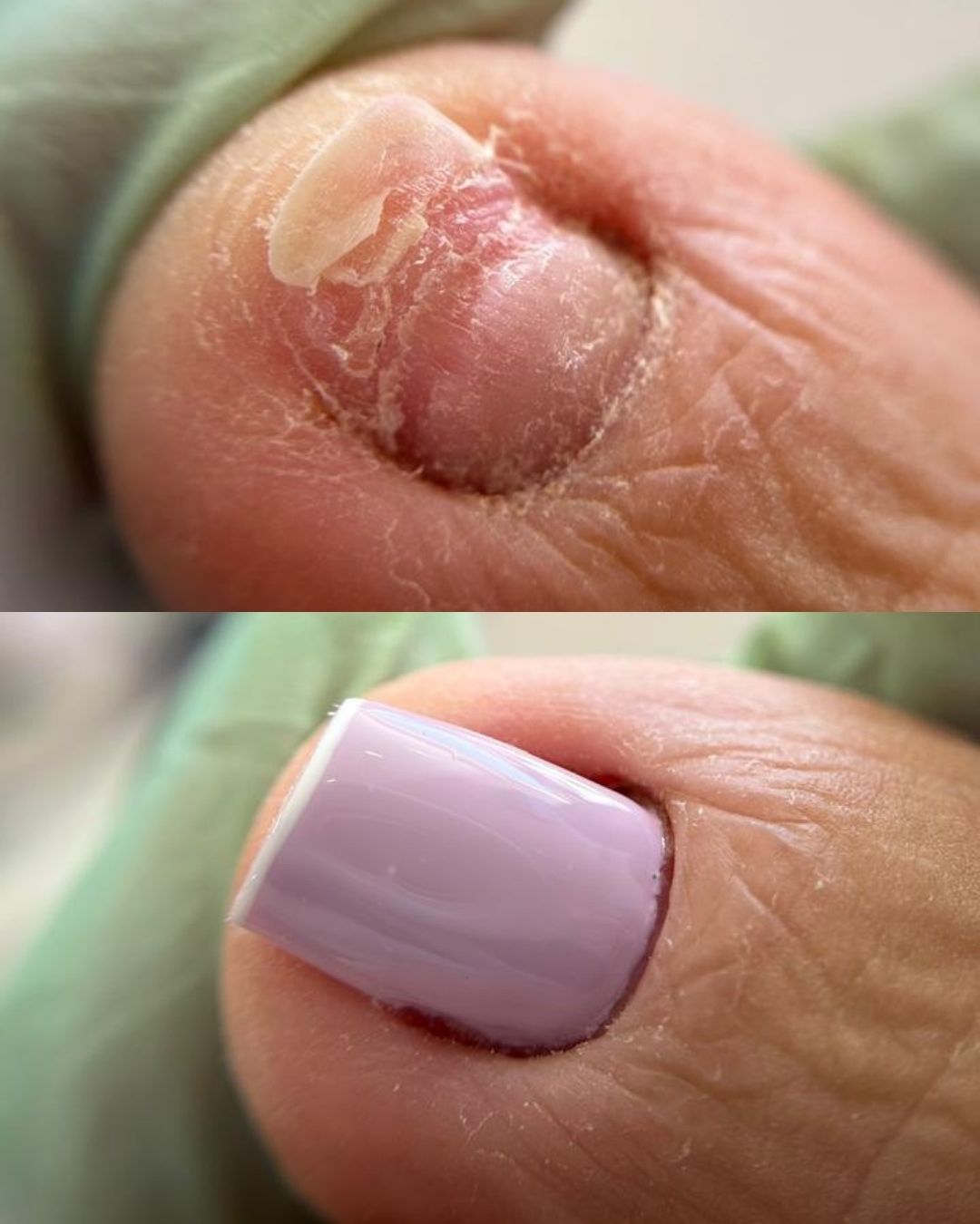 Resultado de unhas